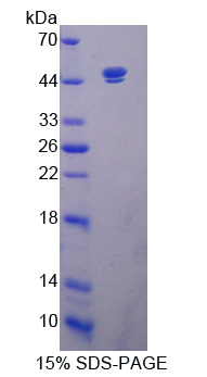 沉默调节蛋白7(SIRT7)重组蛋白,Recombinant Sirtuin 7 (SIRT7)