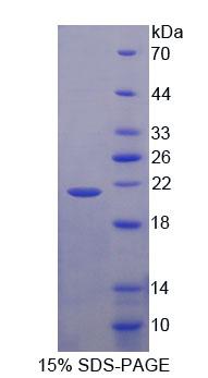 成神经细胞瘤抑制瘤变蛋白1(NBL1)重组蛋白,Recombinant Neuroblastoma, Suppression Of Tumorigenicity 1 (NBL1)