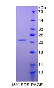 成纤维细胞生长因子10(FGF10)重组蛋白,Recombinant Fibroblast Growth Factor 10 (FGF10)