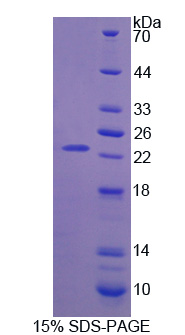 成纖維細(xì)胞生長(zhǎng)因子11(FGF11)重組蛋白,Recombinant Fibroblast Growth Factor 11 (FGF11)