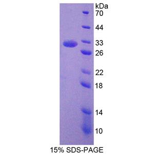 胞质分裂作用因子2(DOCK2)重组蛋白