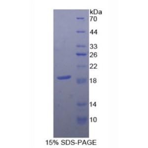 保护素(CD59)重组蛋白
