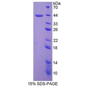 表面活性物质关联蛋白D(SPD)重组蛋白