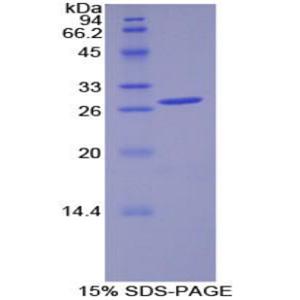 丙酮酸脱氢酶激酶同工酶1(PDK1)重组蛋白