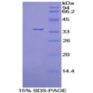 丙酮酸脱氢酶激酶同工酶4(PDK4)重组蛋白,Recombinant Pyruvate Dehydrogenase Kinase 4 (PDK4