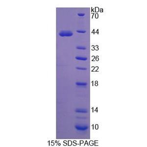 补体成分4a(C4a)重组蛋白,Recombinant Complement Component 4a (C4a)