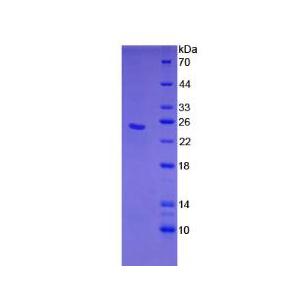 补体成分4c(C4c)重组蛋白,Recombinant Complement Component 4c (C4c)