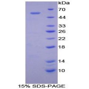 补体因子D(CFD)重组蛋白
