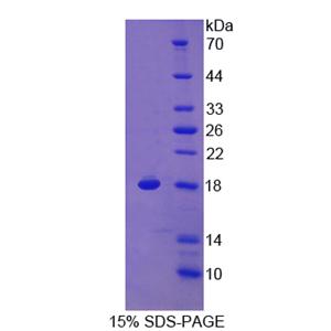 补体应答基因32(RGC32)重组蛋白