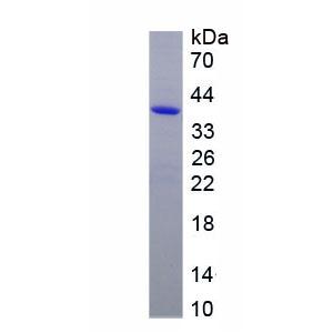 肠碱性磷酸酶(ALPI)重组蛋白,Recombinant Alkaline Phosphatase, Intestinal (ALPI)