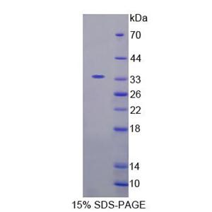 肠细胞激酶(ICK)重组蛋白,Recombinant Intestinal Cell Kinase (ICK)