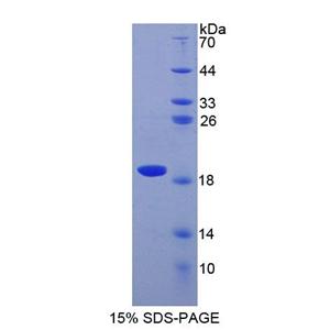 超氧化物歧化酶1(SOD1)重组蛋白