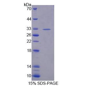 巢蛋白2(NID2)重组蛋白,Recombinant Nidogen 2 (NID2)