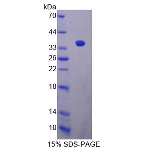 沉默调节蛋白4(SIRT4)重组蛋白
