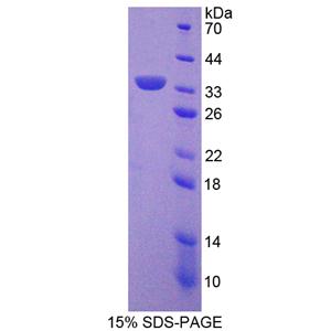 沉默调节蛋白5(SIRT5)重组蛋白