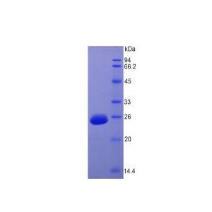 成纤维细胞生长因子15(FGF15)重组蛋白,Recombinant Fibroblast Growth Factor 15 (FGF15)