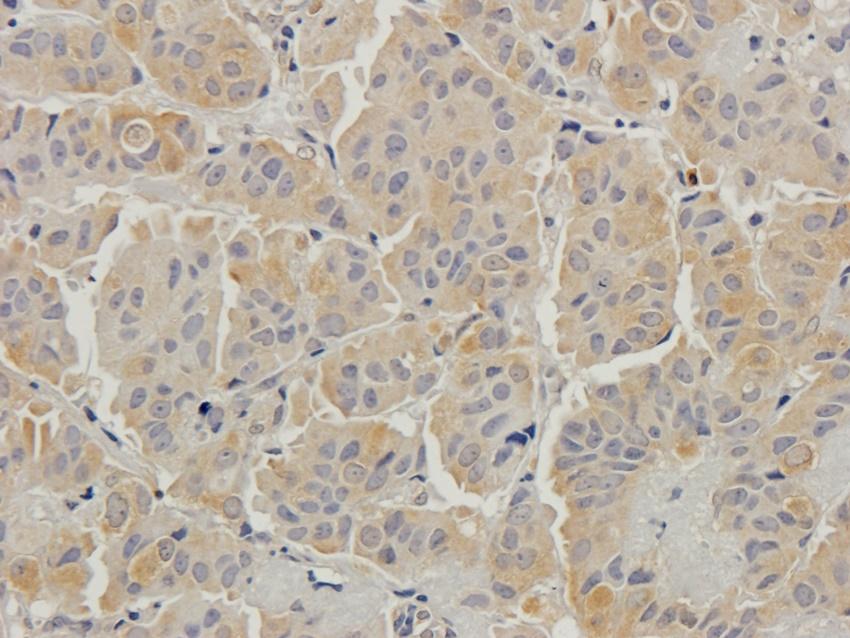 Beclin 1 antibody