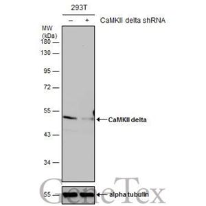 CaMKII delta antibody