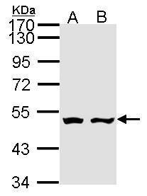 AKD1  antibody [N1], N-term