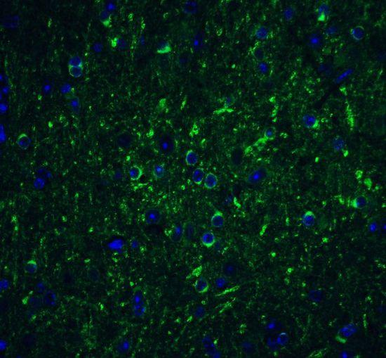 Beclin 1 antibody