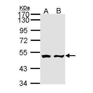 AKD1  antibody [N1], N-term