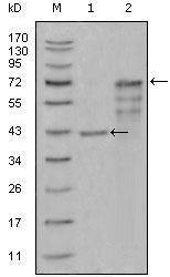 CHIT1 antibody [1D9G2,1D9G4,2B4G3]