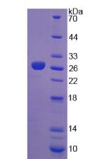 成纖維細(xì)胞生長(zhǎng)因子19(FGF19)重組蛋白,Recombinant Fibroblast Growth Factor 19 (FGF19)