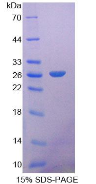成纤维细胞生长因子21(FGF21)重组蛋白,Recombinant Fibroblast Growth Factor 21 (FGF21)