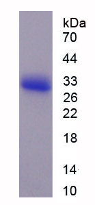 成纖維細胞生長因子受體2(FGFR2)重組蛋白,Recombinant Fibroblast Growth Factor Receptor 2 (FGFR2)