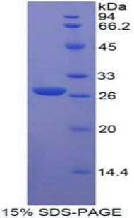 成纤维细胞生长因子受体样蛋白1(FGFRL1)重组蛋白,Recombinant Fibroblast Growth Factor Receptor Like Protein 1 (FGFRL1)