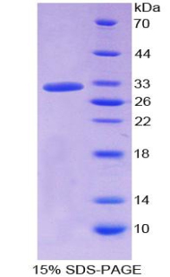 触珠蛋白相关蛋白(HPR)重组蛋白,Recombinant Haptoglobin Related Protein (HPR)