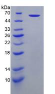 穿孔素1(PRF1)重组蛋白,Recombinant Perforin 1 (PRF1)