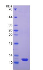 雌激素受体β(ERb)重组蛋白,Recombinant Estrogen Receptor Beta (ERb)