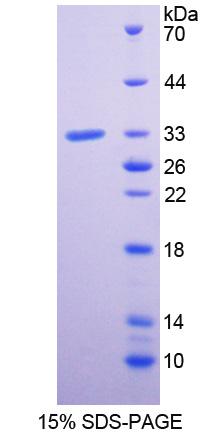 丛状蛋白A1(PLXNA1)重组蛋白,Recombinant Plexin A1 (PLXNA1)