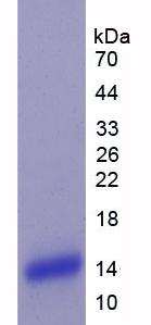 丛状蛋白B1(PLXNB1)重组蛋白,Recombinant Plexin B1 (PLXNB1)