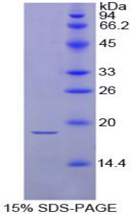 促甲状腺素β(TSHb)重组蛋白,Recombinant Thyroid Stimulating Hormone Beta (TSHb)