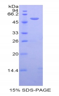 促甲状腺素释放激素(TRH)重组蛋白,Recombinant Thyrotropin Releasing Hormone (TRH)