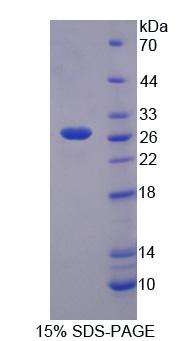 促甲狀腺素受體(TSHR)重組蛋白,Recombinant Thyroid Stimulating Hormone Receptor (TSHR)