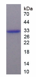 促泌素(SCGN)重组蛋白,Recombinant Secretagogin (SCGN)