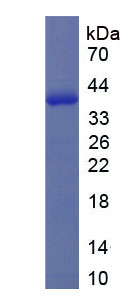 促肾上腺皮质素释放激素结合蛋白(CRHBP)重组蛋白,Recombinant Corticotropin Releasing Hormone Binding Protein (CRHBP)