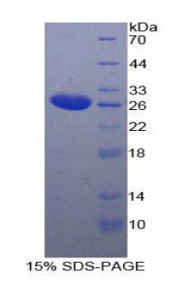 促微管蛋白聚合蛋白(TPPP)重組蛋白,Recombinant Tubulin Polymerization Promoting Protein (TPPP)