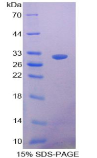 簇集蛋白(CLU)重组蛋白,Recombinant Clusterin (CLU)