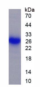 催乳素(PRL)重组蛋白,Recombinant Prolactin (PRL)