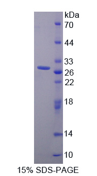 催乳素受体(PRLR)重组蛋白,Recombinant Prolactin Receptor (PRLR)