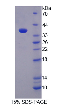 单氨氧化酶B(MAOB)重组蛋白,Recombinant Monoamine Oxidase B (MAOB)