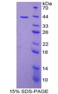 单核细胞趋化蛋白2(MCP2)重组蛋白,Recombinant Monocyte Chemotactic Protein 2 (MCP2)