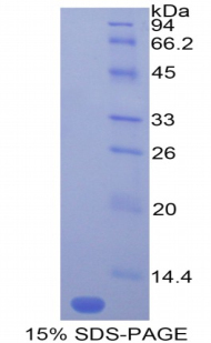 单核细胞趋化蛋白5(MCP5)重组蛋白,Recombinant Monocyte Chemotactic Protein 5 (MCP5)