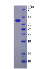 单酰甘油脂肪酶(MGL)重组蛋白,Recombinant Lipase, Monoacylglycerol (MGL)