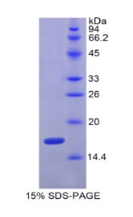 膽固醇-25-羥化酶(CH25H)重組蛋白,Recombinant Cholesterol-25-Hydroxylase (CH25H)