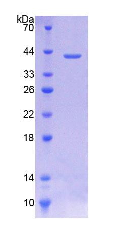 胆碱转运蛋白样蛋白1(CTL1)重组蛋白,Recombinant Choline Transporter Like Protein 1 (CTL1)